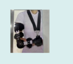 Elbow Contracture Orthosis