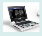 Laptop Ultrasound Scanner