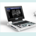 Laptop Ultrasound Scanner